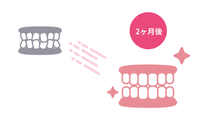 最短2ヶ月
